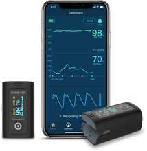 Load image into Gallery viewer, Health Care Pulse Blood Oxygen Monitor- Medical Supplies